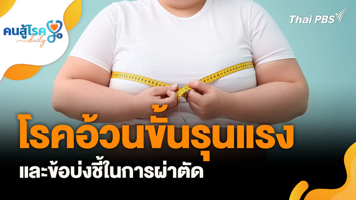 โรคอ้วนขั้นรุนแรงและข้อบ่งชี้ในการผ่าตัด, ดื่มน้ำเย็นหลังกินข้าว เสี่ยงโรคมะเร็งและหัวใจ?