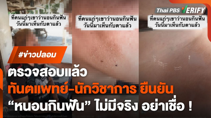 ตรวจสอบพบ : "ทันตแพทย์-นักวิชาการ" ยันชัด "หนอนกินฟัน" ไม่มีจริง !