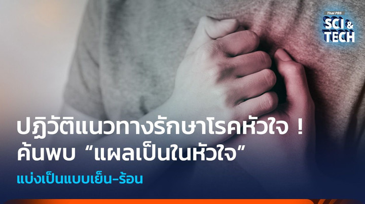 ปฏิวัติแนวทางรักษาโรคหัวใจ ค้นพบ “แผลเป็นในหัวใจ” แบบเย็น-ร้อน