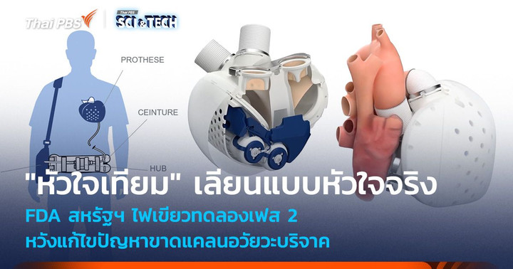 "หัวใจเทียม" เลียนแบบหัวใจจริง แก้ไขปัญหาขาดแคลนอวัยวะบริจาค