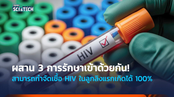 ผสาน 3 การรักษาเข้าด้วยกัน! สามารถกำจัดเชื้อ HIV ในลูกลิงแรกเกิดได้ 100%