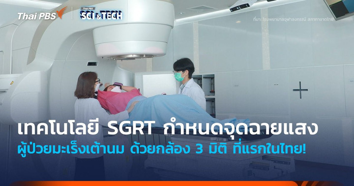 ที่แรกในไทย! นำเทคโนโลยี SGRT กำหนดจุดฉายแสงผู้ป่วยมะเร็งเต้านม ด้วยกล้อง 3 มิติ
