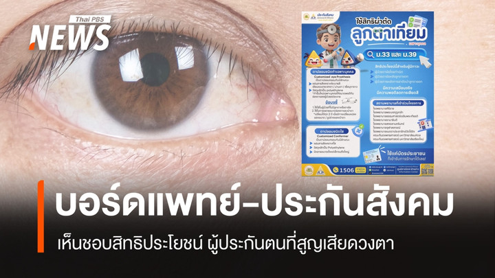 บอร์ดแพทย์-ประกันสังคม เห็นชอบสิทธิประโยชน์ ผู้ประกันตนที่สูญเสียดวงตา 