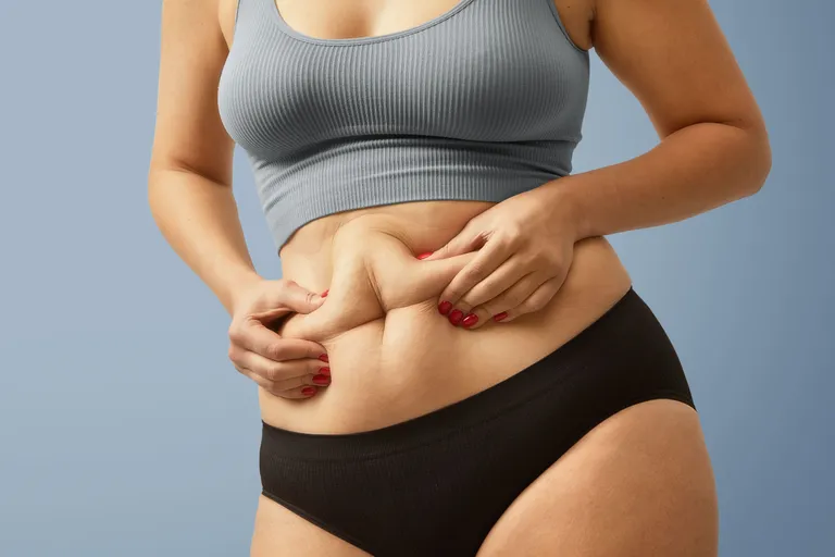 woman-body-fat-belly-obese-woman-hands-holding-excessive-tummy-fat-change-diet-lifestyle-concept-shape-up-healthy-stomach-muscle-studio-anonymous-shot-photo-body-parts