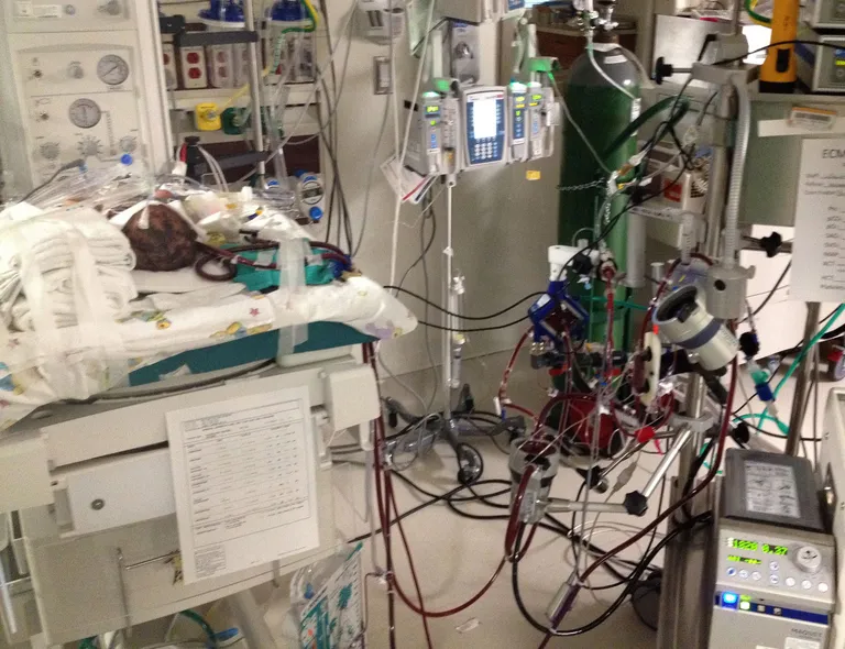 ECMO