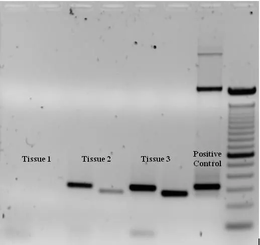 การทำ Gel Electrophoresis เป็นหนึ่งในเทคนิคการยืนยันผลการ PCR