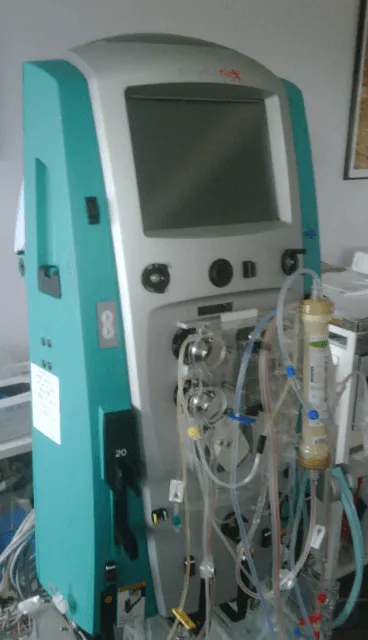 เครื่อง Hemofiltration ใช้สำหรับการกรองโมเลกุลขนาดใหญ่ออกจากกระแสเลือด เช่น Myoglobin