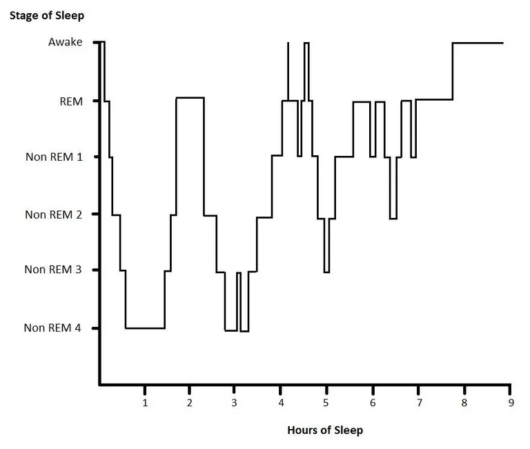Hypnogram หรือกราฟแสดงระดับการนอนหลับ