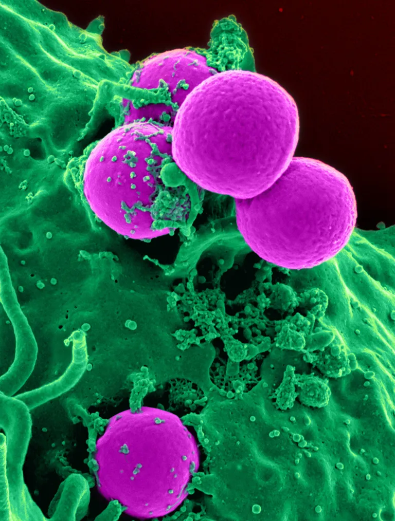 เชื้อดื้อยาปฏิชีวนะหลายชนิด MRSA