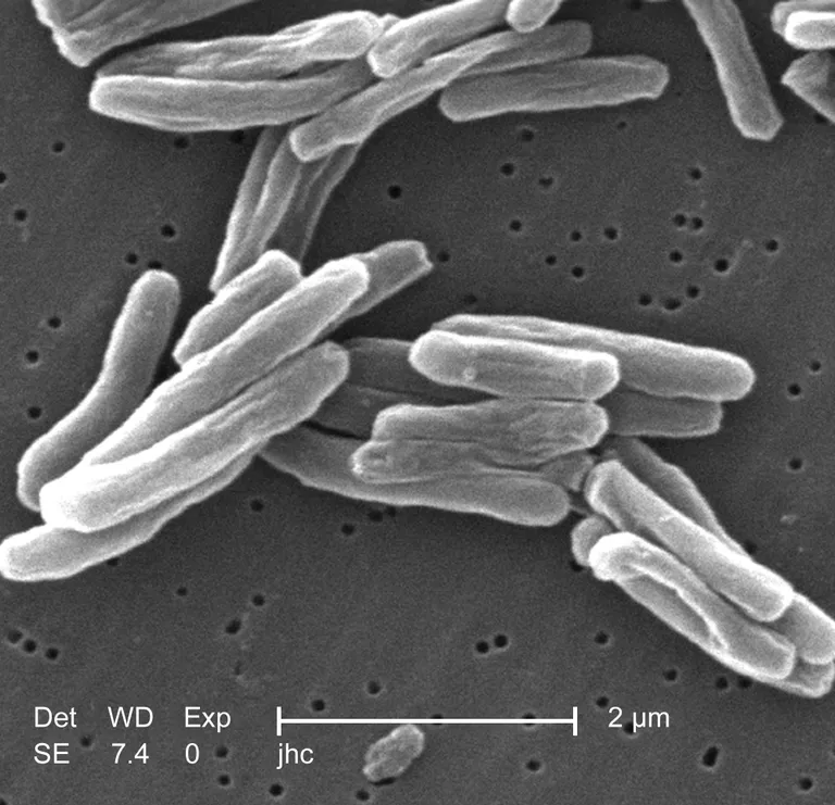 ภาพถ่ายจากกล้องจุลทรรศน์อิเล็กตรอนของเชื้อแบคทีเรีย Mycobacterium tuberculosis ที่มีลักษณะสีขาวทรงกระบอก