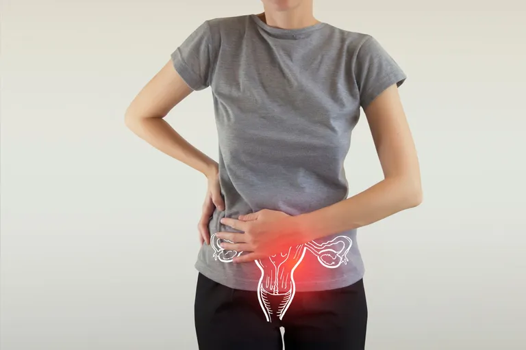 ปวดประจำเดือน (Dysmenorrhea)