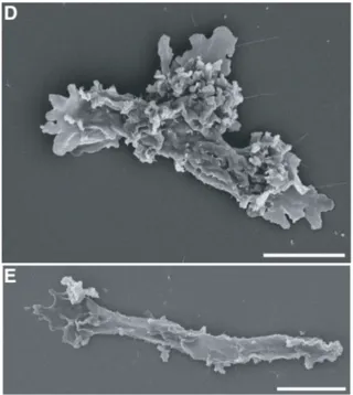 ภาพถ่ายอะมีบาทนร้อนจากกล้องจุลทรรศน์อิเล็กตรอน ภาพจาก Rappaport et al., Cell, 2026