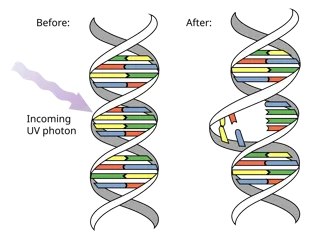 กระบวนการ Pyrimidine dimer ที่เกิดความผิดปกติของบส DNA เมื่อได้รับรังสี UV