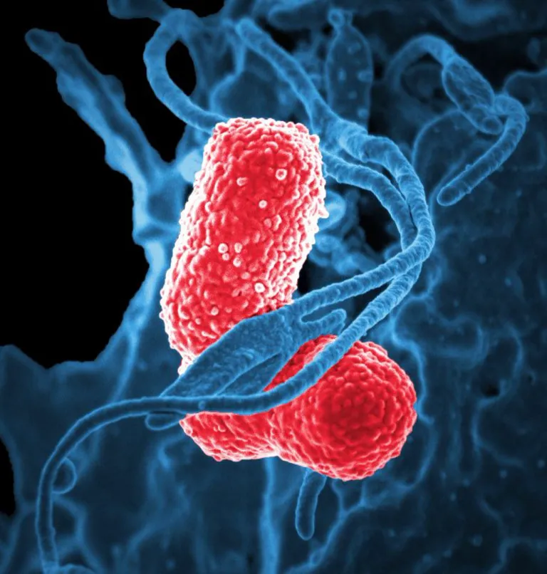 เชื้อดื้อยาปฏิชีวนะหลายชนิด Klebsiella pneumoniae