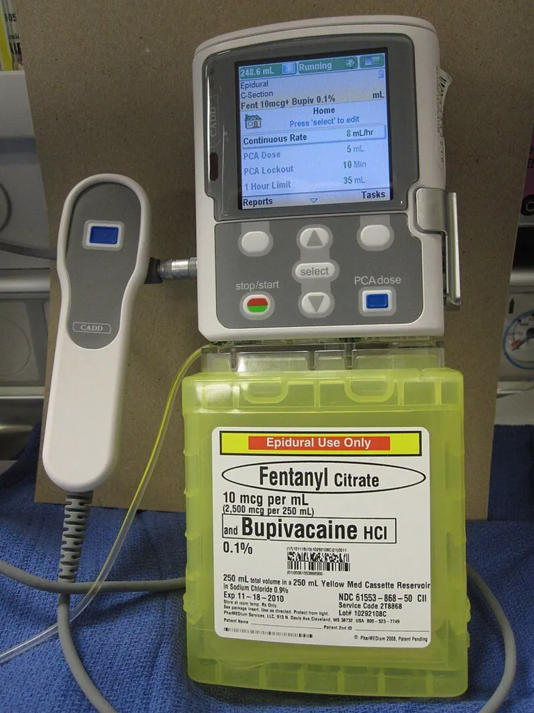 Patient-controlled Analgesia สำหรับการให้ผู้ป่วยควบคุมโดสยาของตนเองได้
