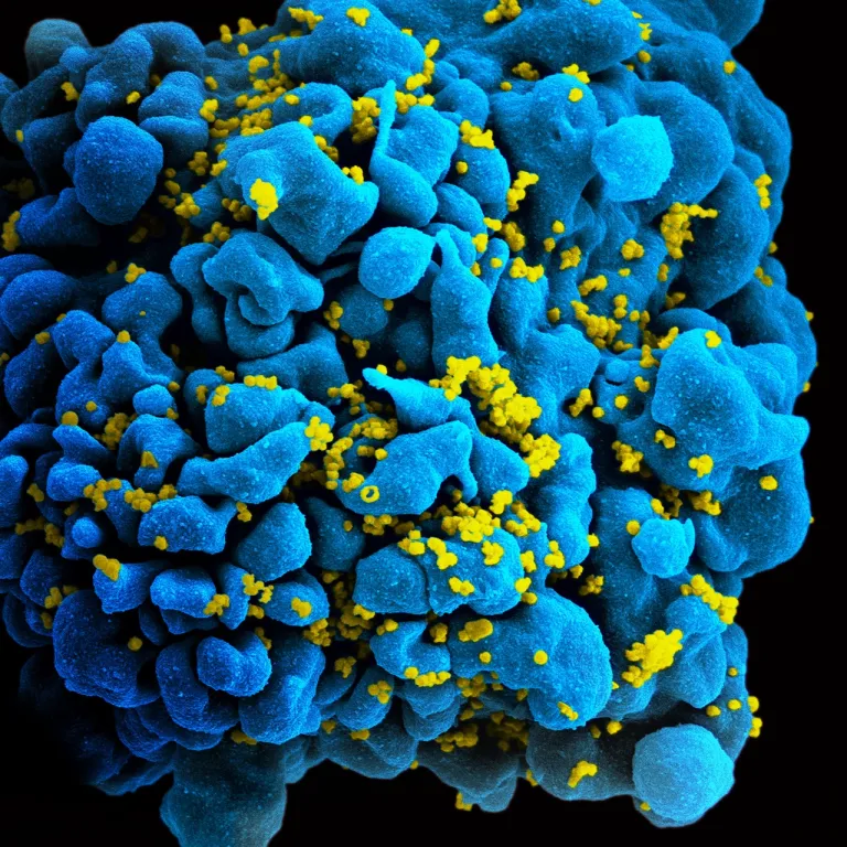 ภาพ SEM ของ Helper T Cell (สีฟ้า) ซึ่งติดเชื้อ HIV และกำลังผลิตเชื้อไวรัส HIV ใหม่ออกมา (สีเหลือง)