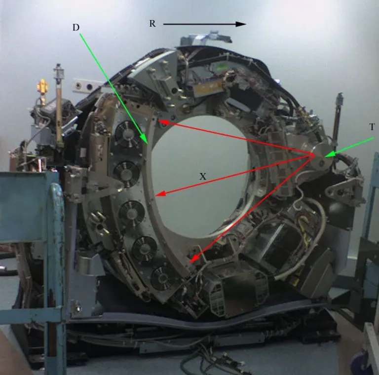 ภาพเครื่อง CT Scan เมื่อถูกถอดฝาครอบออก ทำให้เห็นชิ้นส่วนภายในซึ่งปกติแล้วจะมีฝาครอบไว้เพื่อความปลอดภัย