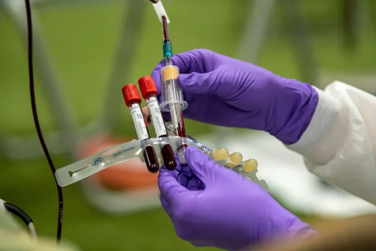 ภาพขณะกำลังเก็บเลือดระหว่างการบริจาคเลือดเข้าหลอด Vacutainer เพื่อนำเลือดไปตรวจเพิ่มเติม