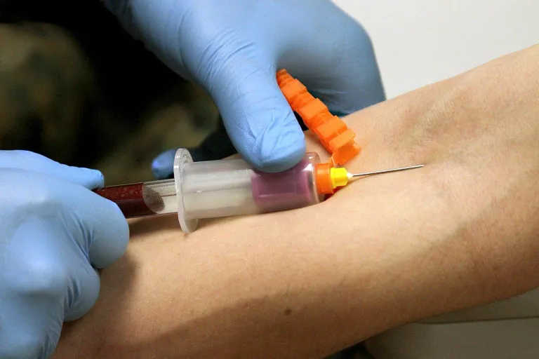 การเจาะเลือดเข้าหลอด Vacutainer สามารถทำได้ด้วยการใช้เข็มเจาะเลือดสุญญากาศ