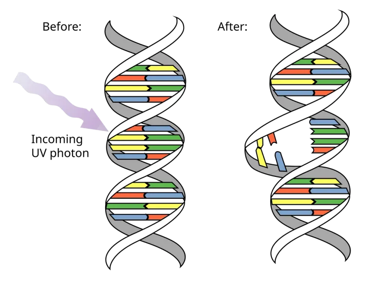 กระบวนการ Pyrimidine dimer ที่เกิดความผิดปกติของบส DNA เมื่อได้รับรังสี UV