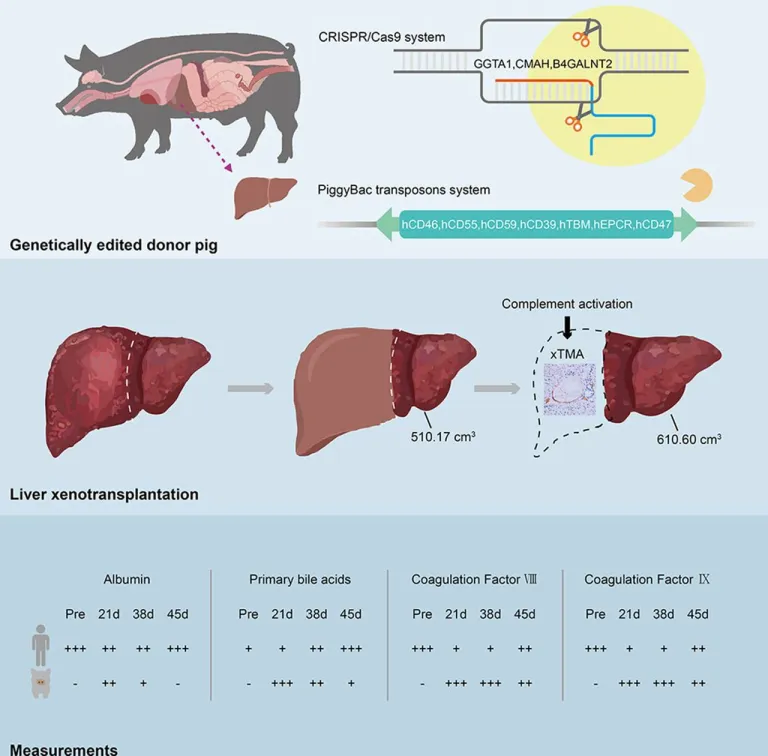 แนวทางการเปลี่ยนตับหมูให้กับผู้ป่วย ภาพจาก journal-of-hepatology