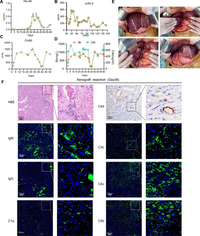การผ่าตัดผู้ป่วยรับปลูกถ่าย “ตับหมู” คนแรกของโลก ภาพจาก journal-of-hepatology