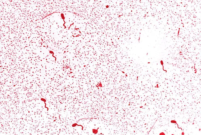 ภาพของเชื้อแบคทีเรีย Vibrio cholera