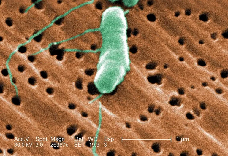 ภาพ Scanning Electron Microscope ของเชื้อแบคทีเรีย Vibrio vulnificus