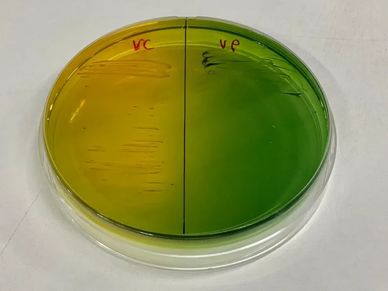 การเลี้ยงเชื้อ Vibrio cholerae และ Vibrio parahaemolyticusในจานเพาะเชื้อ