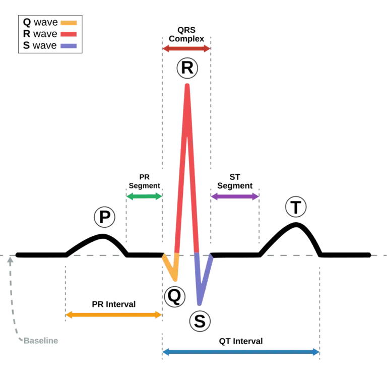 การวัดคลื่นไฟฟ้าหัวใจหรือ ECG เป็นวิธีในการเฝ้าระวังและตรวจหา AF ที่ได้ผลที่สุด โดยเฉพาะอย่างยิ่งการตรวจวัดระยะยาว