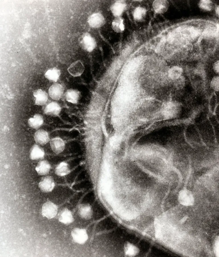 ภาพกล้องจุลทรรศน์ TEM ขณะที่ Phage เกาะอยู่กับแบคทีเรียที่เป็นเหยื่อ