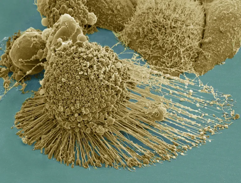 HeLa cell สุดยอดแห่งการละเมิดความเป็นส่วนตัว