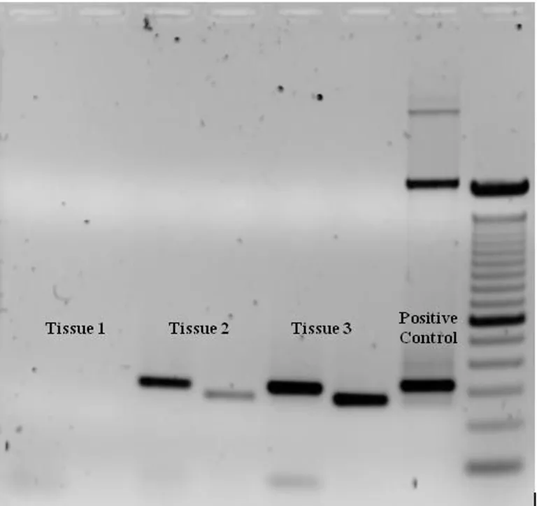 การทำ Gel Electrophoresis เป็นหนึ่งในเทคนิคการยืนยันผลการ PCR