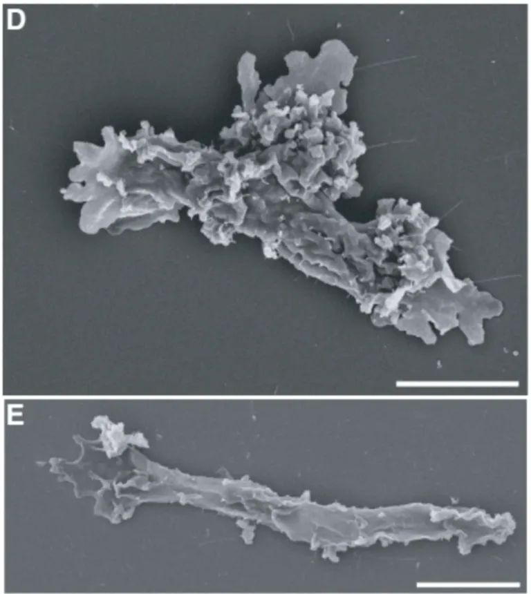 ภาพถ่ายอะมีบาทนร้อนจากกล้องจุลทรรศน์อิเล็กตรอน ภาพจาก Rappaport et al., Cell, 2026