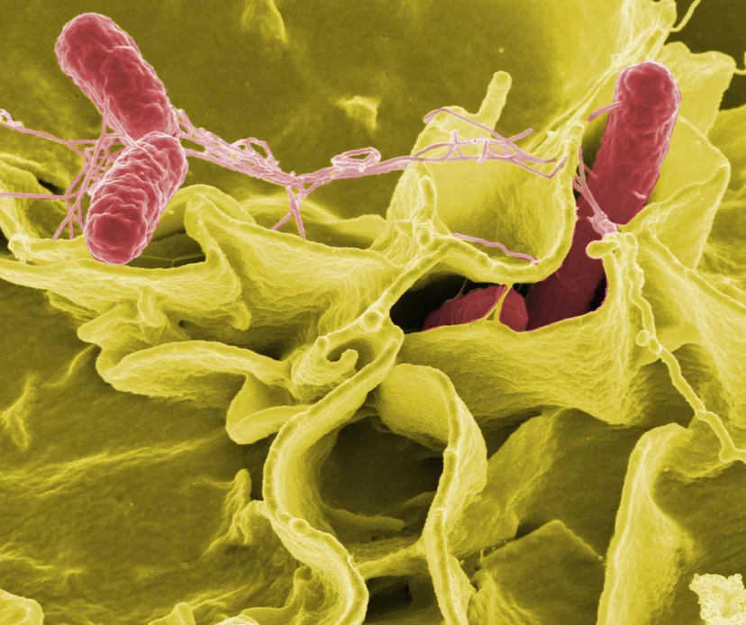 ภาพเชื้อ Salmonella โดย Rocky Mountain Laboratories
